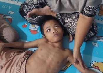 Anak Ditelantarkan Ibu Akibat Sakit Parah yang Menyakitkan