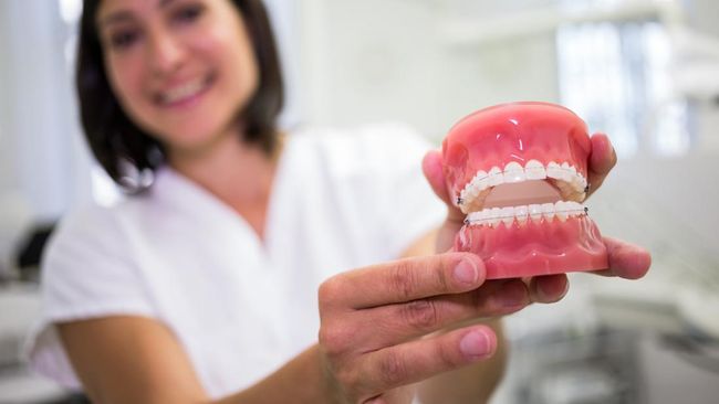 Menkes Heran Banyak Warga RI Mengalami Gigi Berlubang